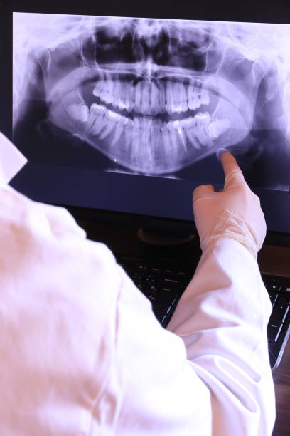 Best Emergency Root Canal Therapy in Westernport, MD